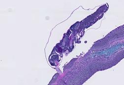 A sea louse (on top) attaches itself to a fish fin
